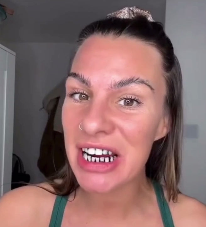 Smile Kit ( Bandes Blanchissantes Violettes )